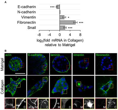 The Role of Microenvironmental Cues and Mechanical Loading Milieus in Breast Cancer Cell Progression and Metastasis